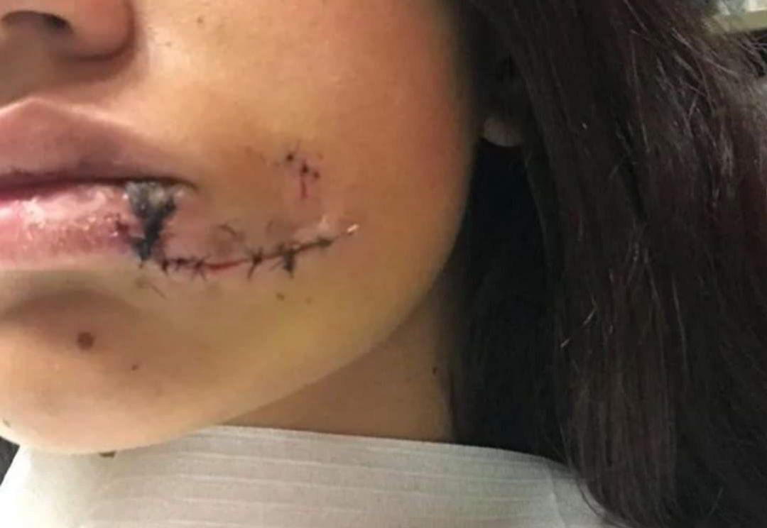 Hacía una sesión de fotos con su perro, pero el animal se enojó y la atacó salvajemente 16