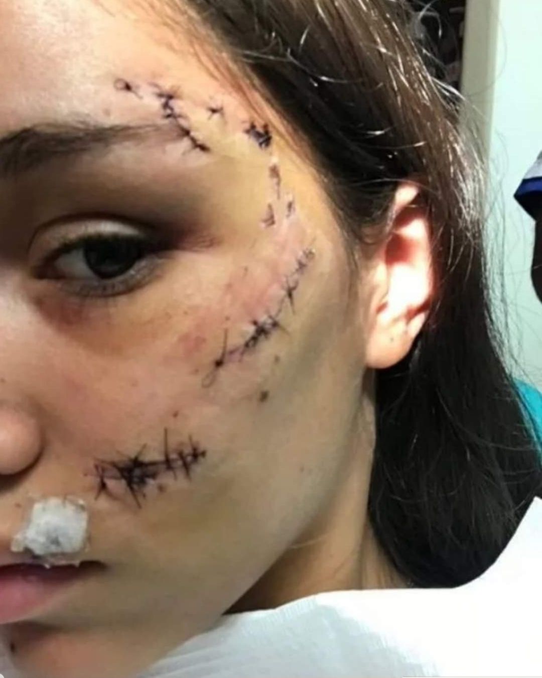 Hacía una sesión de fotos con su perro, pero el animal se enojó y la atacó salvajemente 15