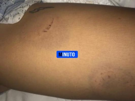 Magdalena: Golpeó brutalmente a su ex y le dijo "te voy a matar, de acá no te vas viva" 9