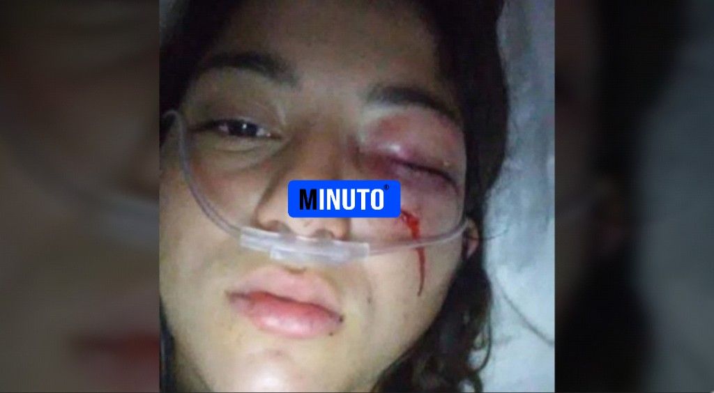 Magdalena: Golpeó brutalmente a su ex y le dijo "te voy a matar, de acá no te vas viva" 10