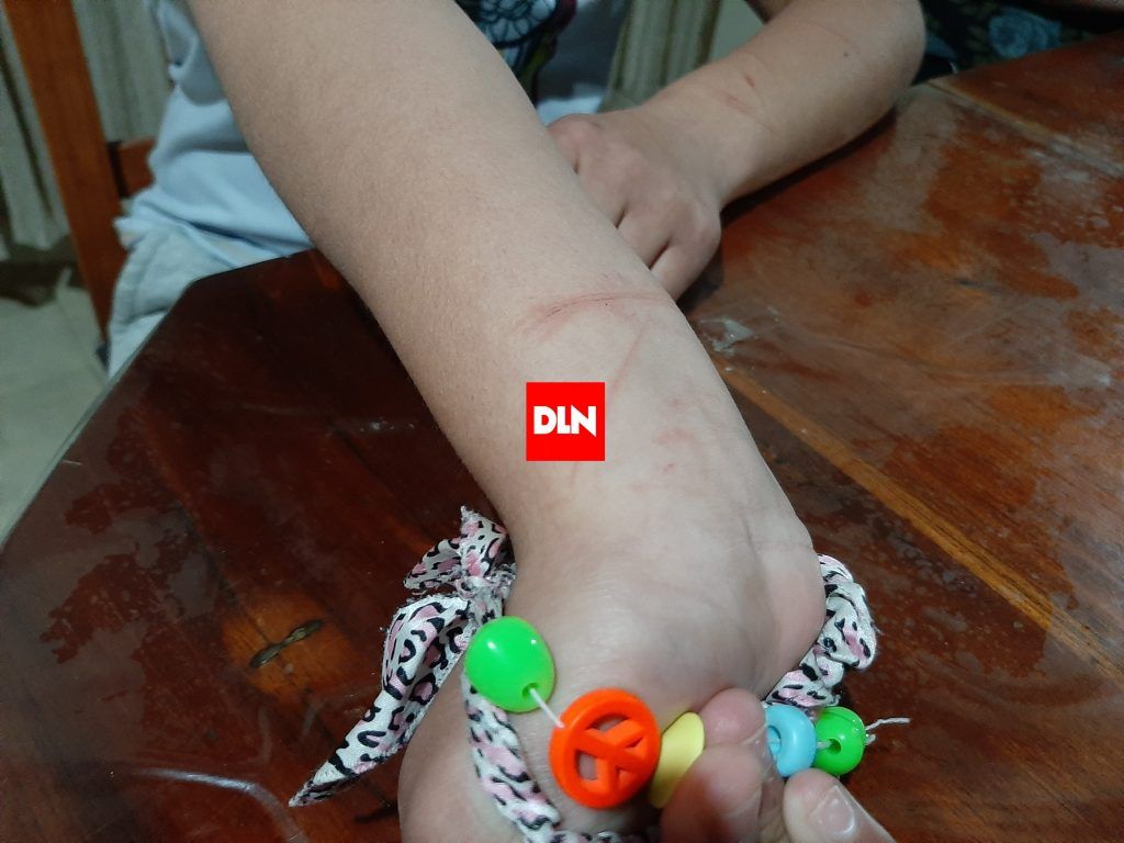 Brutal intento de robo a plena luz del día en Brandsen: lastiman a una nena de 13 años 3