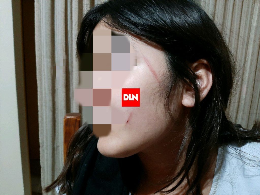 Brutal intento de robo a plena luz del día en Brandsen: lastiman a una nena de 13 años 2