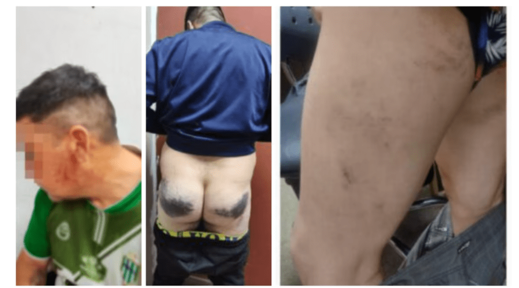 Terror en la comisaría: detienen a tres policías por torturas y humillaciones sexuales en Ensenada 4